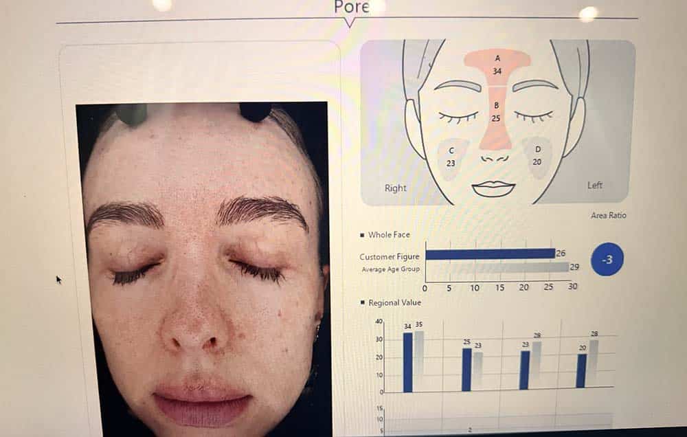 klinika piekna seul Koreańska analiza skóry w Seulu. Sprawdziłam, czy K-Beauty naprawdę działa Ile lat ma Twoja twarz