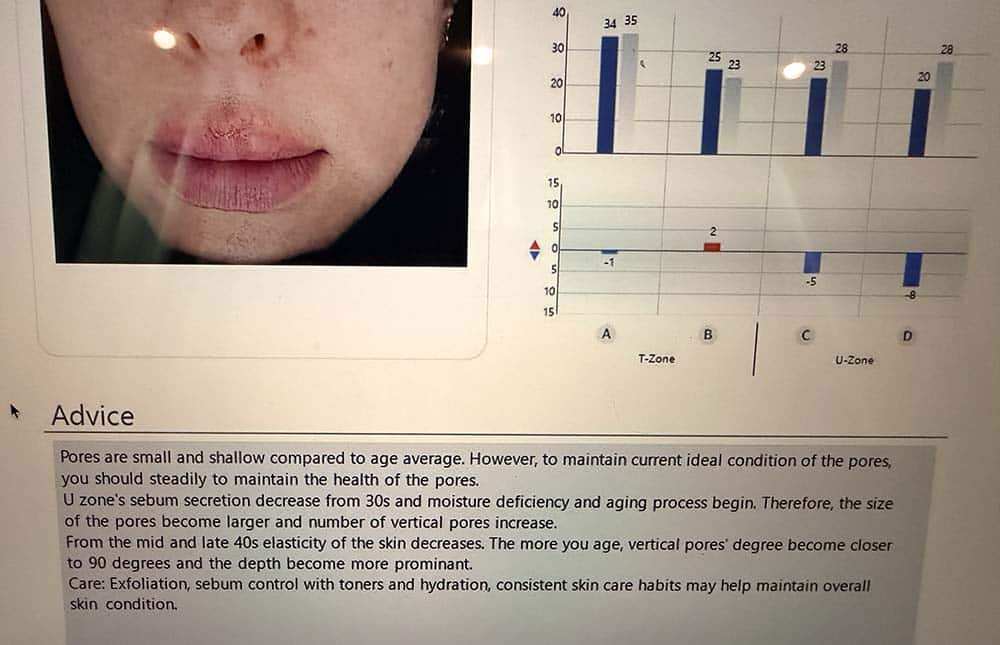 seul kllinika piekna Koreańska analiza skóry w Seulu. Sprawdziłam, czy K-Beauty naprawdę działa Stan skóry sprawdza klinika w Seulu